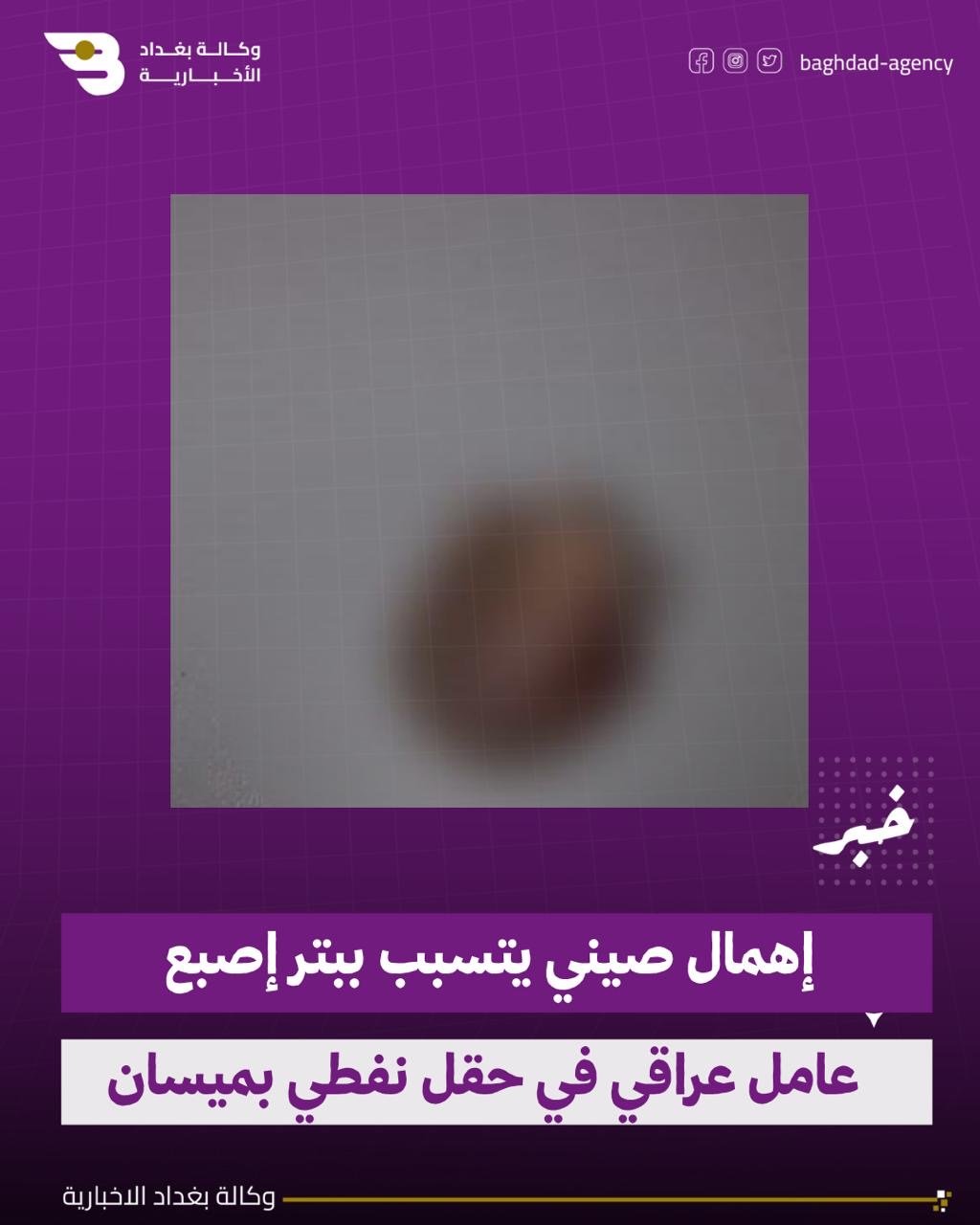 إهمال صيني يتسبب ببتر إصبع عامل عراقي في حقل نفطي بميسان